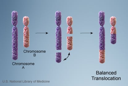 Balanced translocation