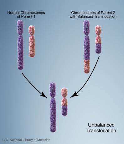 Unbalanced translocation