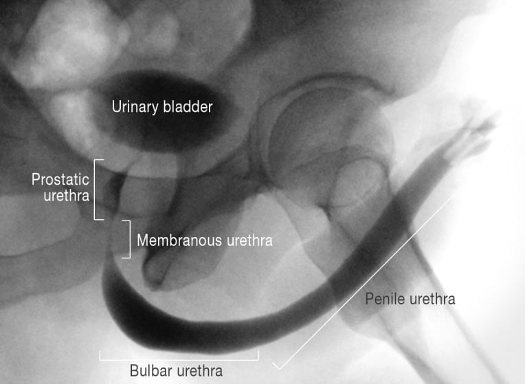 Normal urethra parts