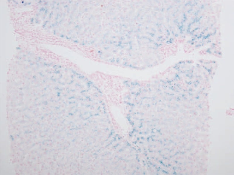 Lipofuscin pigment in perivenular hepatocytes