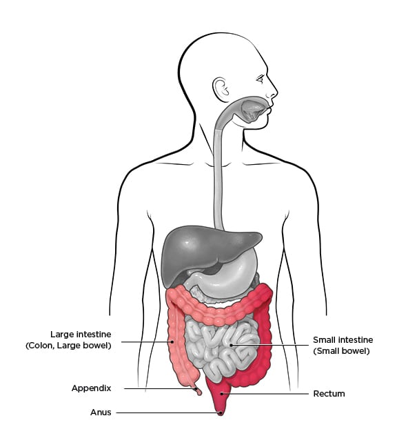 Ulcerative colitis