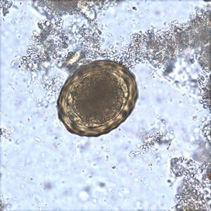 Acscaris egg