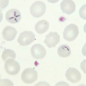 Babesia