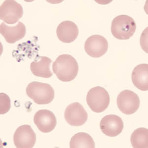 Babesia