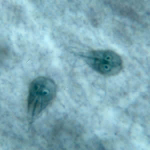 Giardia lamblia also called duodenalis