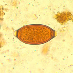 Egg of T. trichiura in an iodine-stained wet mount