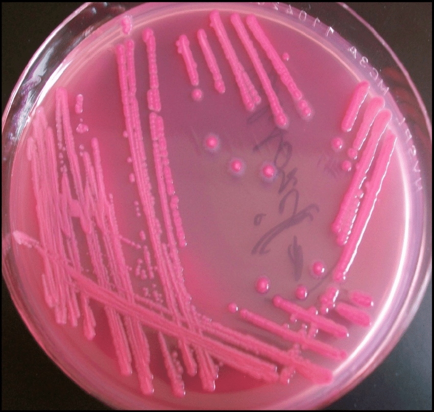 Lactose fermenting
colonies E.coli