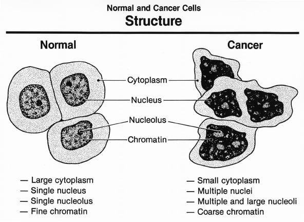 Normal vs cancer cells